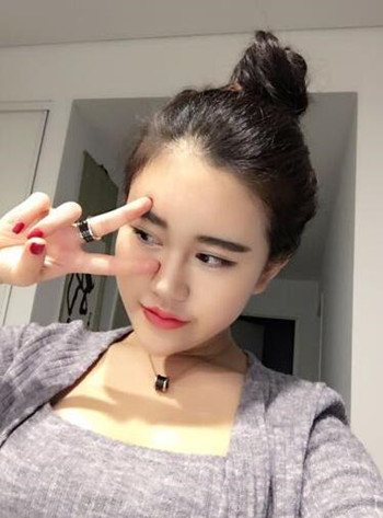 面部自體脂肪填充加隆鼻整形 讓我擁有一張網(wǎng)紅臉