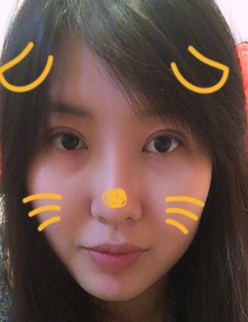 隆鼻整形雙眼皮開眼角讓我從屌絲逆襲成女神