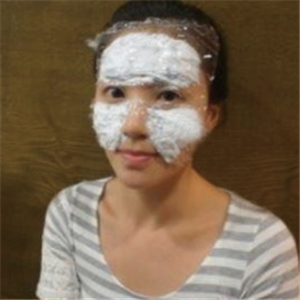 美女注射玻尿酸除皺過程分享，還有前后對比果圖片哦~