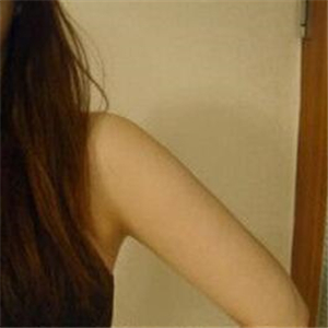 做了吸脂瘦手臂四個月，果很自然，有恢復(fù)前后對比果圖片哦~