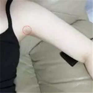 做了吸脂瘦手臂四個月，果很自然，有恢復(fù)前后對比果圖片哦~