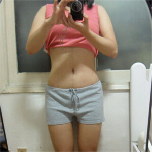 京韓做腰腹吸脂四個月的恢復照片，喬愛軍醫(yī)生的技術很好哦~