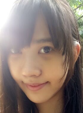 大鼻子做了隆鼻整形后終于變秀氣了