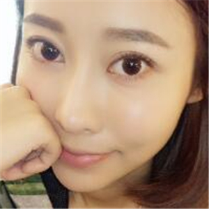 去年做了面部埋埋蛋白線.提升緊致除皺，分享恢復(fù)前后對比果圖片~