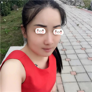 愛斯克做了高強(qiáng)度聚焦超聲5個月了，看看我的果照片，不錯哦~~