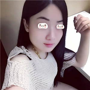 愛斯克做了高強(qiáng)度聚焦超聲5個月了，看看我的果照片，不錯哦~~