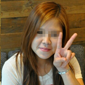 去年做了玻尿酸填充去法令紋，有前后對比果圖片哦~