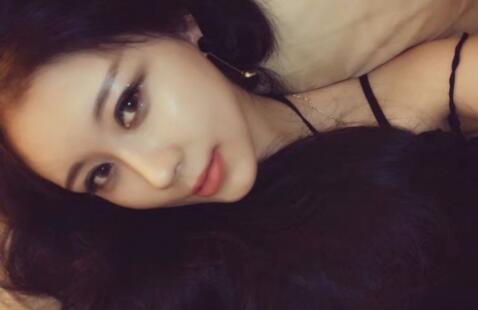 自體脂肪豐太陽穴額頭