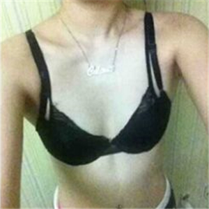 珠江醫(yī)院做的自體脂肪隆胸手術(shù)，三個(gè)月了，有前后對(duì)比果圖片哦~