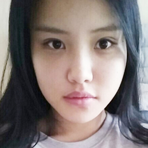 做下頜角整形手術(shù)半年了，給你們看看恢復(fù)過程照片吧~