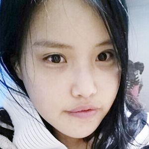 做下頜角整形手術(shù)半年了，給你們看看恢復(fù)過程照片吧~