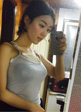 假體隆胸手術(shù)恢復(fù)過程分享，還有前后對(duì)比照片哦