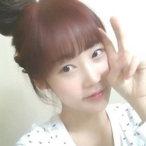 做地包天矯正手術(shù)五個月了，恢復(fù)得不錯，有前后對比果圖片哦~