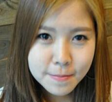 玻尿酸除皺抗衰老去法令紋真實(shí)案例分享