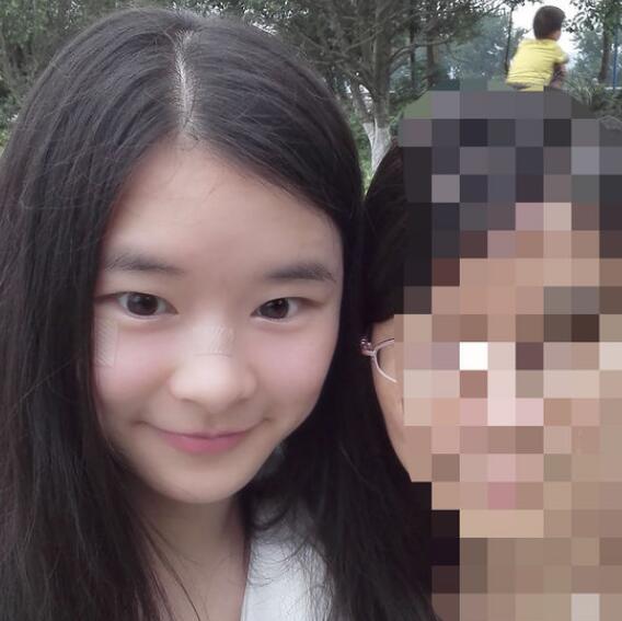 分享手術(shù)切除祛疤恢復(fù)過程希望對(duì)大家有幫助