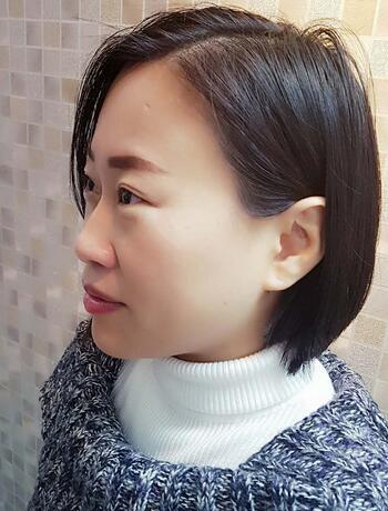 武漢中愛注射瘦臉去魚尾紋一個月