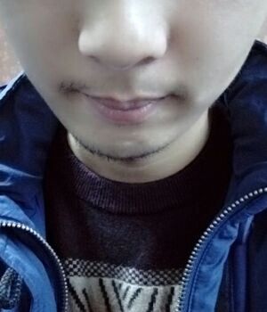 胡須種植后長(zhǎng)出來(lái)的胡子較為滿(mǎn)意