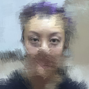 做了眼部電波l皮，一下子年輕了不少啊