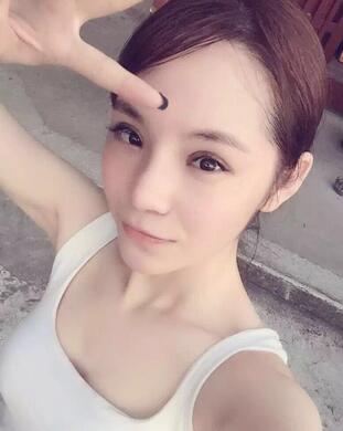 梨花雨隆鼻整形的恢復(fù)經(jīng)歷