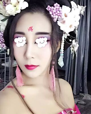 隆鼻失敗修復(fù)后整給鼻形很精致，鄭志敏醫(yī)生做的