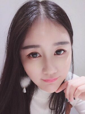 硅膠隆鼻+耳軟骨墊鼻尖后美到朋友認(rèn)不出