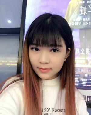 全切雙眼皮修復(fù)后恢復(fù)成漂亮的眼睛了