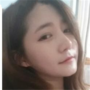 去年做的雙眼皮，分享恢復(fù)過程和前后對比果圖片~