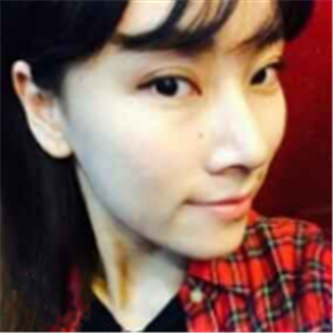 自體脂肪面部填充半年了， 皮膚好了，分享恢復(fù)照片哦~~