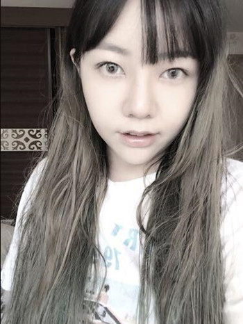 做了隆鼻整形手術(shù)果真的很不錯(cuò) 大家快來(lái)看看吧