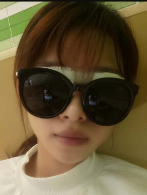 雙眼皮傷口愈合