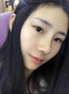 膨體隆鼻拆線兩天了