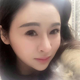 自體脂肪填充面部前后過(guò)程以及對(duì)比照片，真實(shí)案例分享