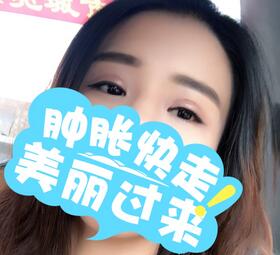 上海韓鏡割雙眼皮一個月