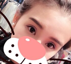 上海韓鏡割雙眼皮一個月