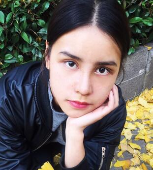 上海韓鏡網(wǎng)紅套餐半個月經(jīng)歷 雙眼皮多項整形+隆鼻整形+脂肪填充