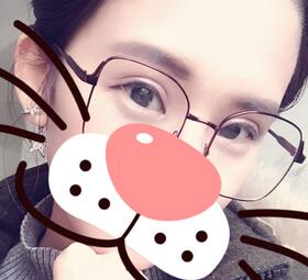 上海韓鏡割雙眼皮一個月