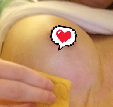 自體脂肪隆胸落實(shí)我擁有豐滿美胸的愿望