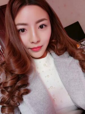 自體脂肪全臉填充之后臉變小了也更精致了