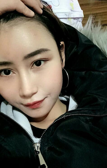 馮斌做的自體脂肪全臉填充大家?guī)臀铱纯垂趺礃? /> </a>
										<a href=