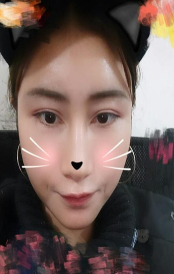 馮斌做的自體脂肪全臉填充大家?guī)臀铱纯垂趺礃? /> </a>
									</div>
								</dd>
							</dl><dl>
								<dt>
							<a href=