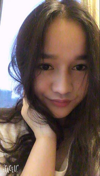 做了隆鼻整形手術(shù)整個(gè)鼻子靈巧了許多 快來圍觀果