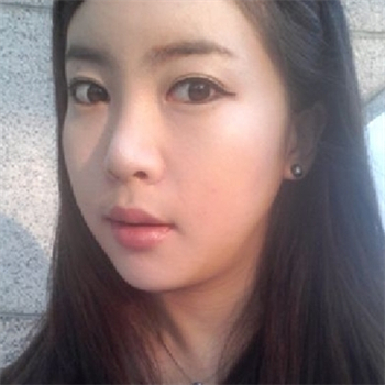 分享美立方做下頜角整形手術(shù)經(jīng)歷，還有前后對比果圖片哦~