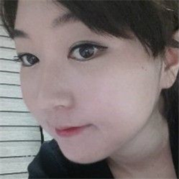 下頜角整形手術(shù)前后對比果圖片分享，還有恢復(fù)過程心路歷程~~~