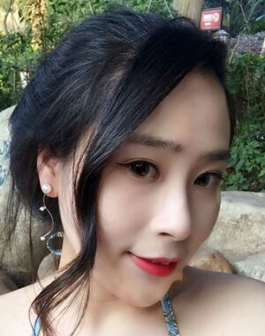 深圳美萊整形醫(yī)院做了進口硅膠墊下巴臉型都變好看了