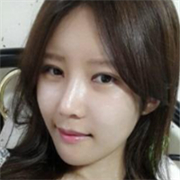 做了埋線雙眼皮、隆鼻、磨下頜角，兩個(gè)月了，分享恢復(fù)照片~