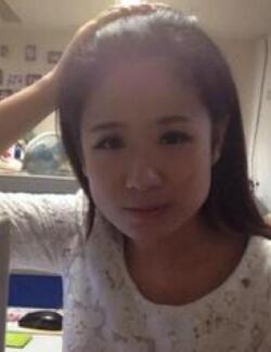 計(jì)劃了很久要去做磨骨整形