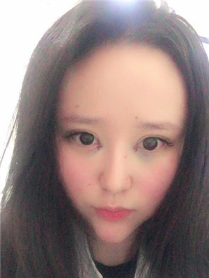 開了眼角之后，眼睛變得很勾人