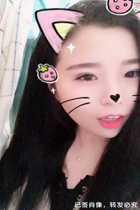 剛做了雙眼皮切開重瞼手術(shù)，恢復(fù)得越來越自然了