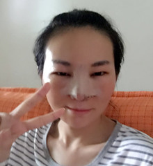 真人記錄了硅膠隆隆鼻整形手術(shù)前后過程，大家進(jìn)來看看吧!