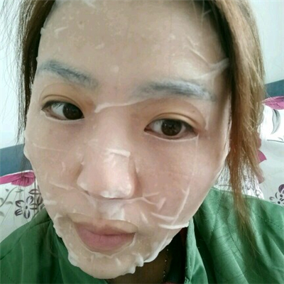 光子嫩膚和下巴脂肪填充術(shù)后果圖片分享，董萍門診做的~